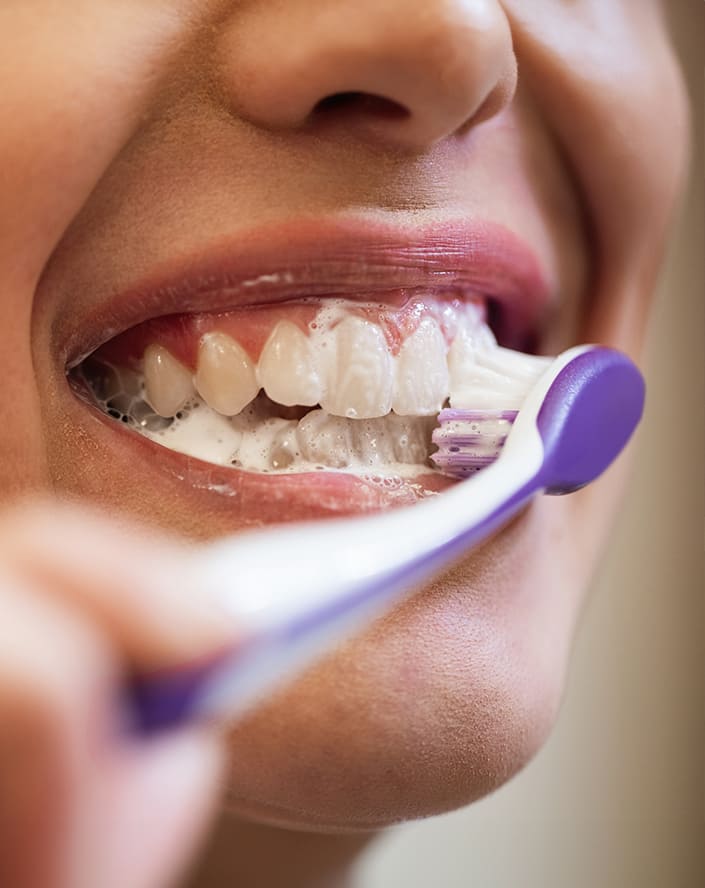 Qué alimentos no debes tomar durante el blanqueamiento dental