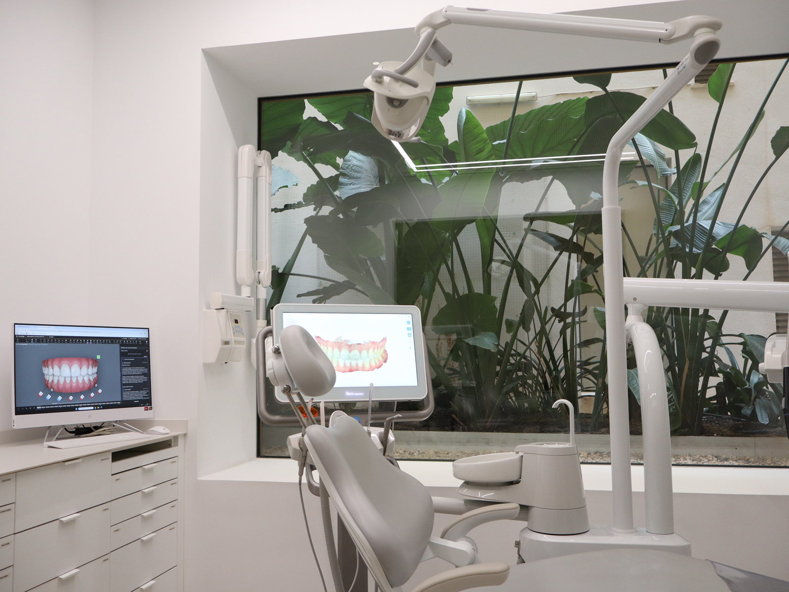 diseño de sonrisa personalizado