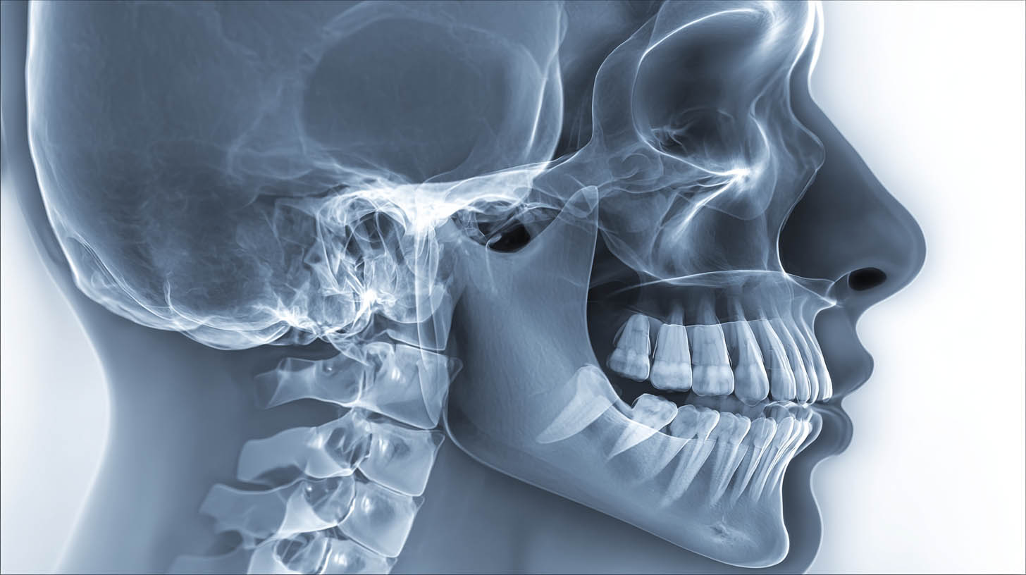 Reconocimiento dental con IA en radiografías DPR