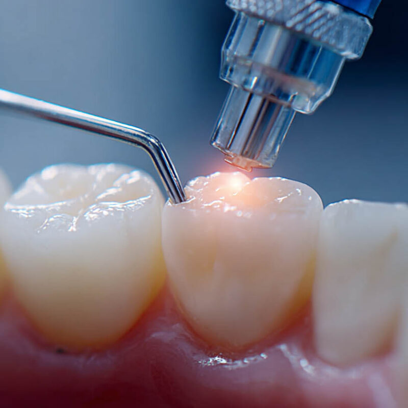 limpieza dental automatizada