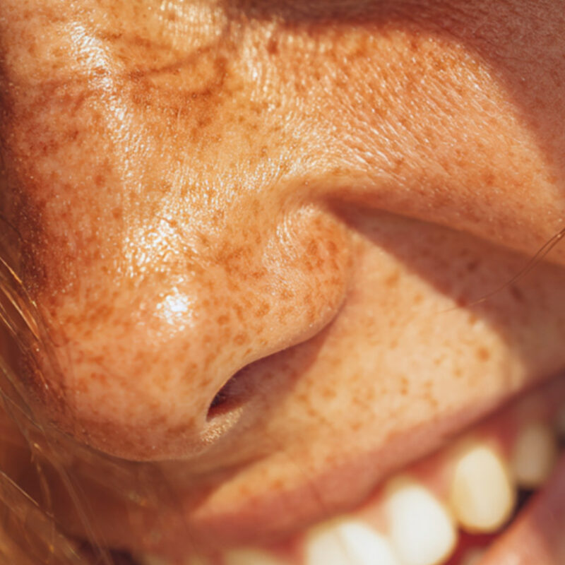 Prevención dental