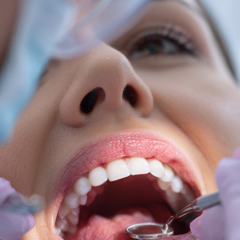 sonrisa y estética dental en valencia