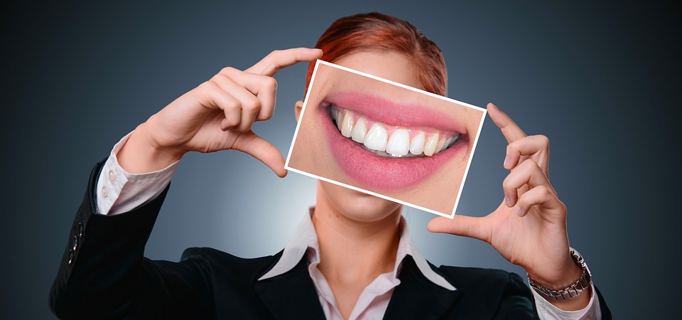 Beneficios de contar con un diseño digital de sonrisa