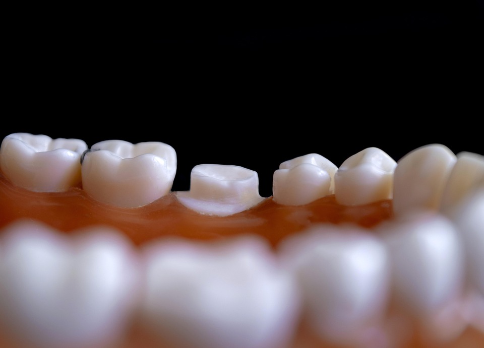 Células madre podrían regenerar dientes perdidos