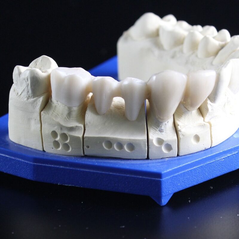 Rejuvenecer la dentadura será sin duda una decisión acertada. La imagen cambia por completo cuando se posee una sonrisa radiante.