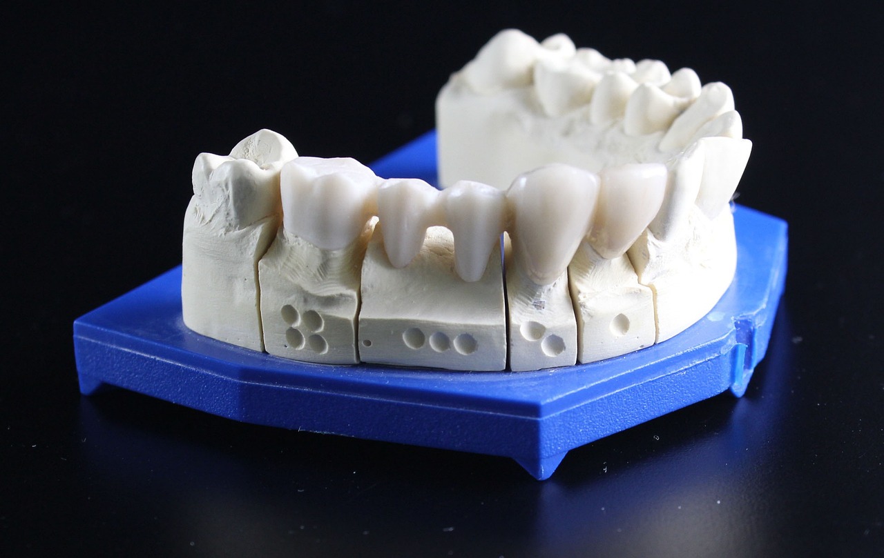 ¿Desea verse más joven? comience con embellecer su dentadura