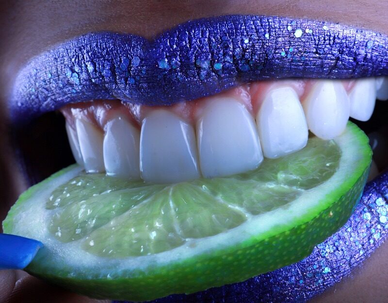 porcelana para las carillas dentales