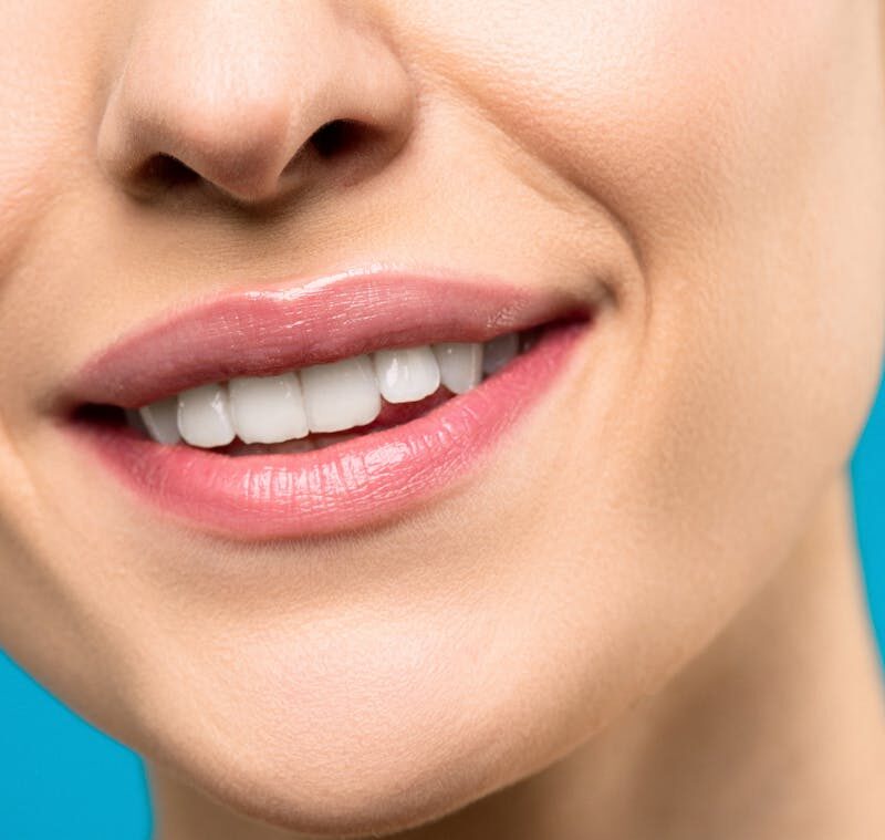 Blanqueamiento dental | Clínica Dental Valencia Marien Morata