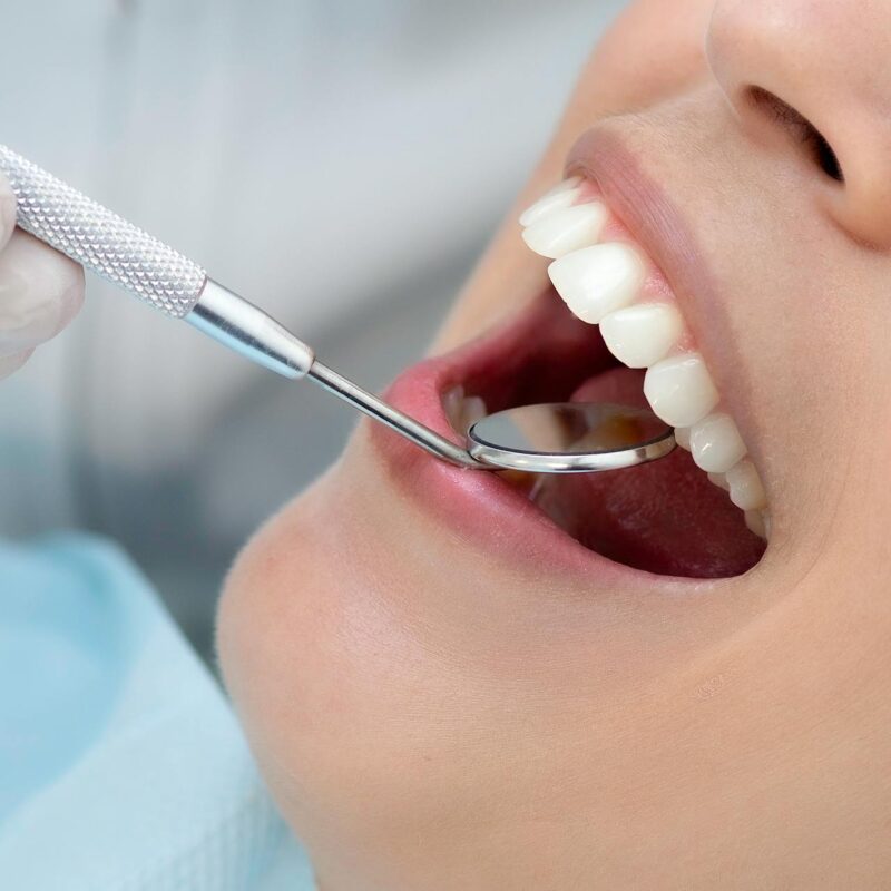 Periodontitis y tumores | Clínica Dental Valencia Marien Morata
