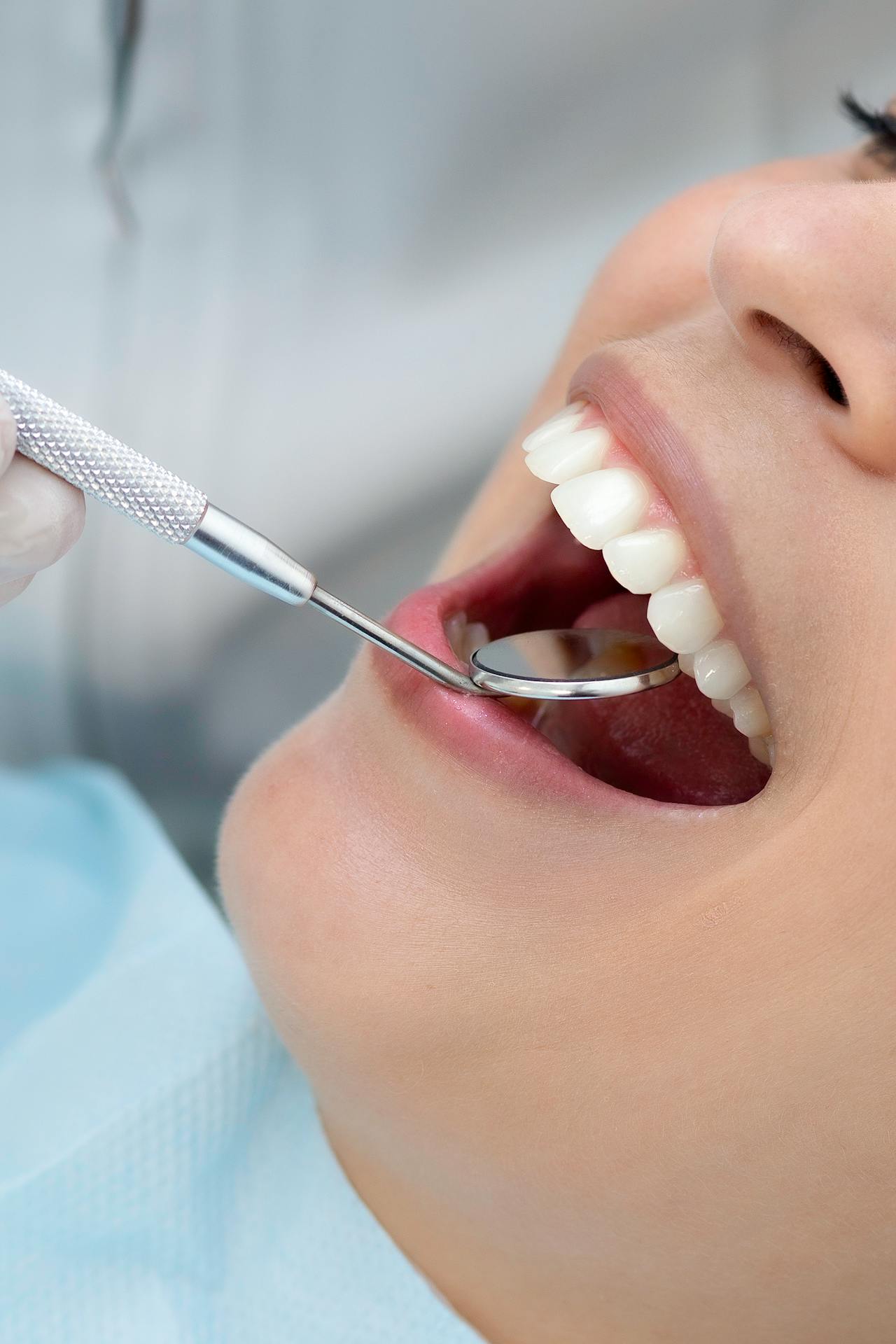 ¿Qué esperar de una limpieza dental profesional?