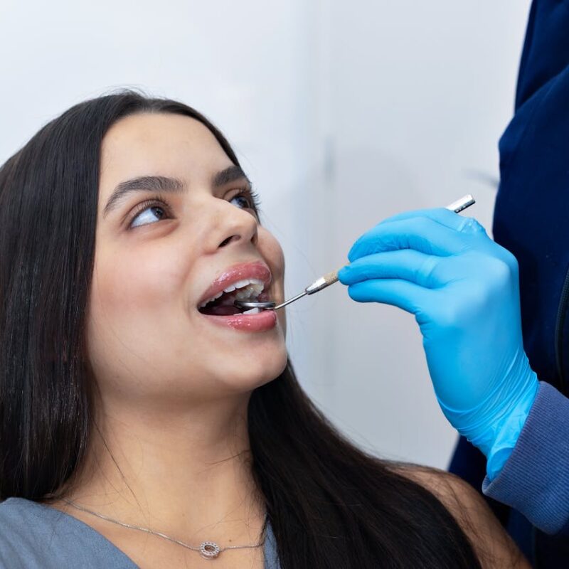 Bordes incisales | Clínica Dental Valencia Marien Morata Roig