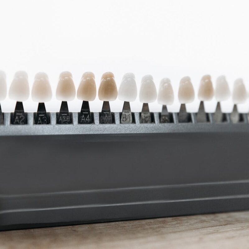 Carillas | Mantenimiento | Clínica Dental Valencia Marien Morata