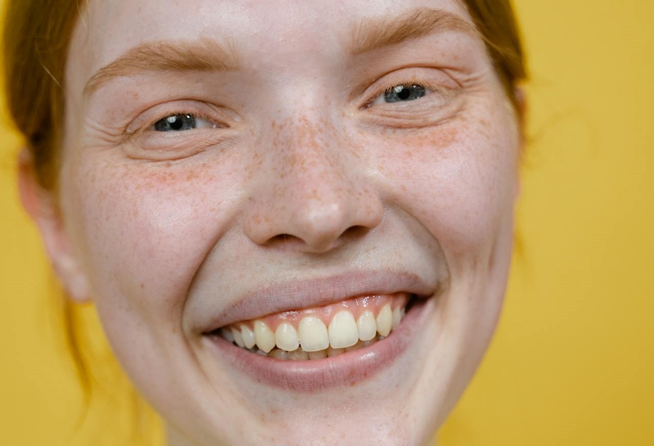 Existen varias opciones para corregir la sonrisa gingival