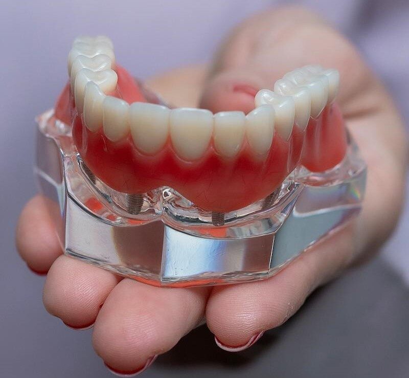 Prótesis dentales | Clínica Dental Valencia Marien Morata Roig