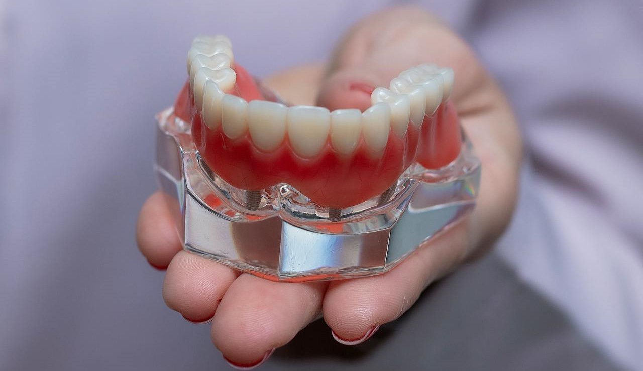 Todo lo que debes saber sobre las prótesis dentales