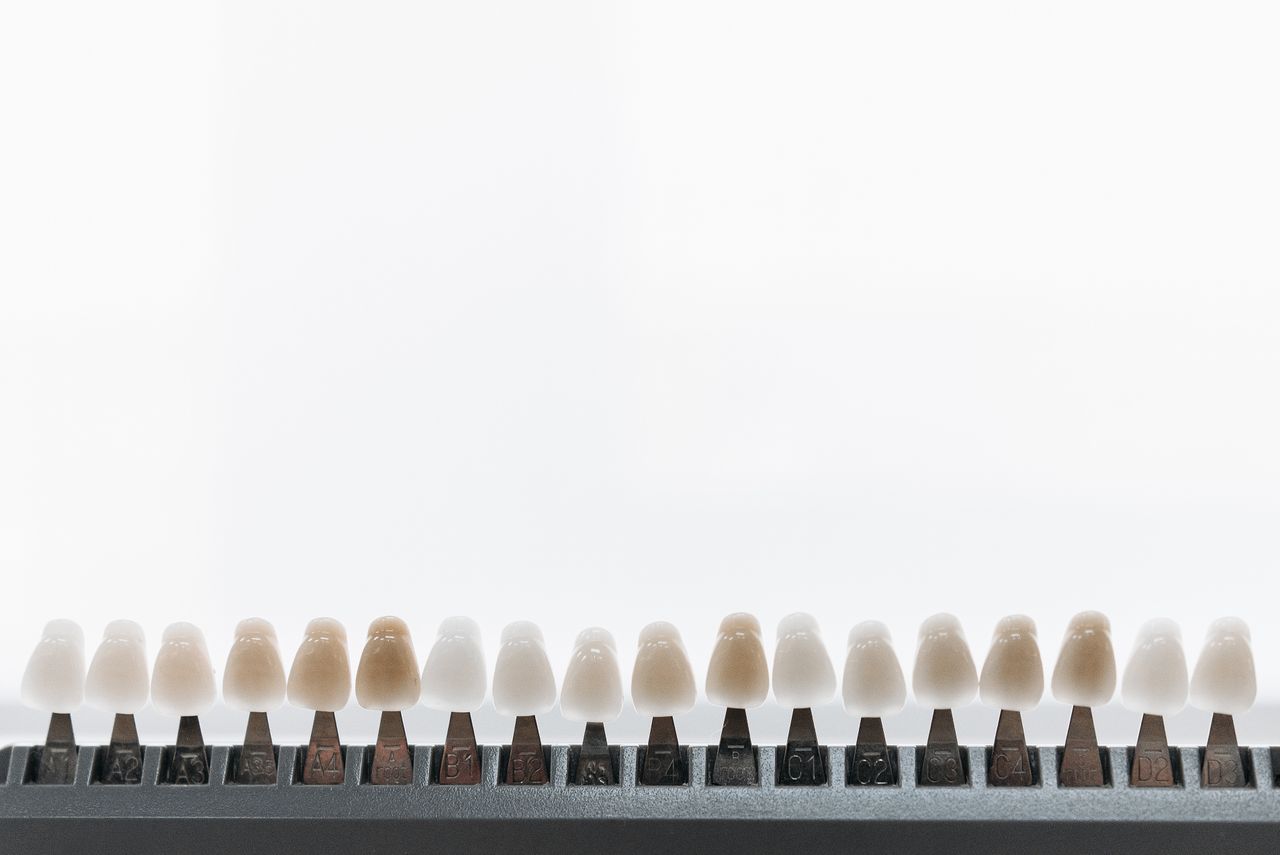 ¿Composite o porcelana? La guía definitiva para elegir las carillas sin equivocarse