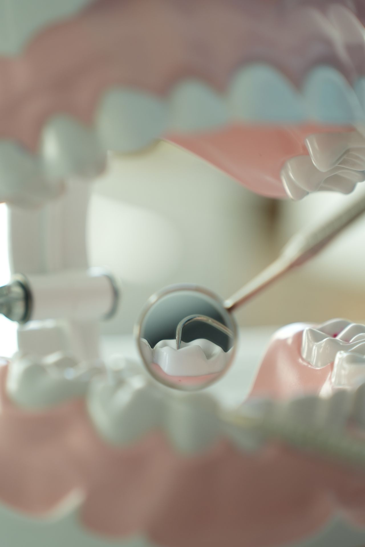 Tener una boca sana es un requisito básico para un tratamiento de estética dental