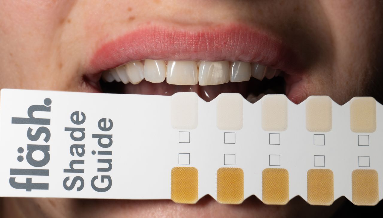 ¿Cada cuánto tiempo se puede repetir un blanqueamiento dental de forma segura?