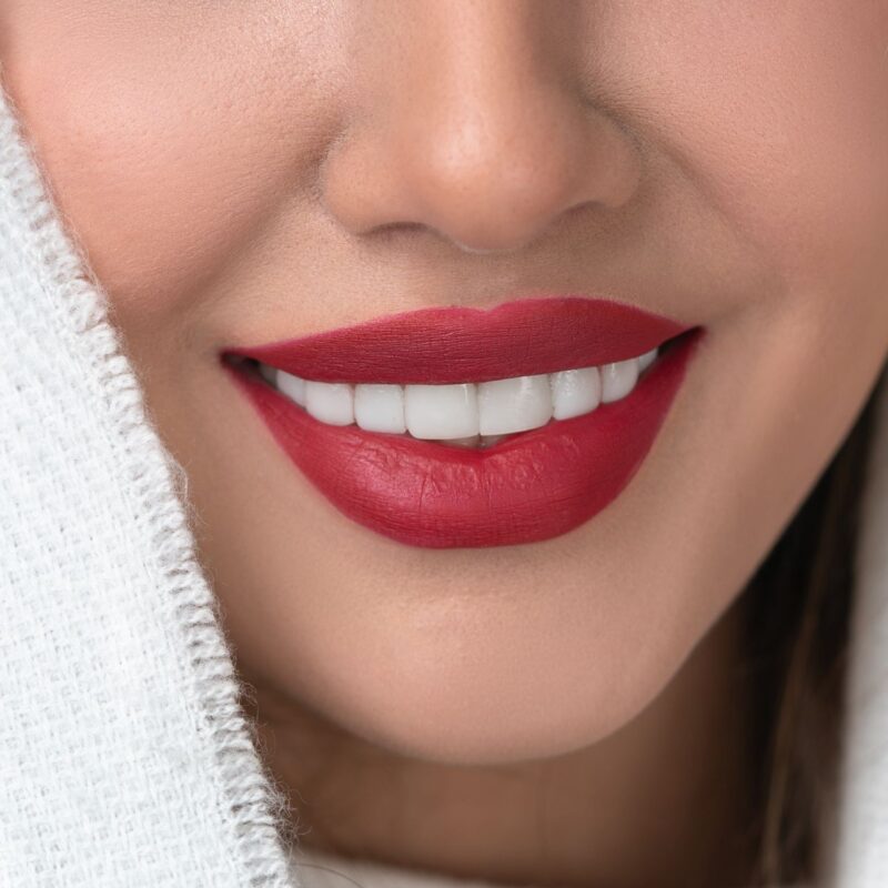 Impresión 3D carillas | Clínica Dental Valencia Marien Morata Roig