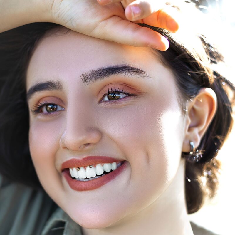 Joyas en los dientes | Clínica Dental Valencia Marien Morata Roig