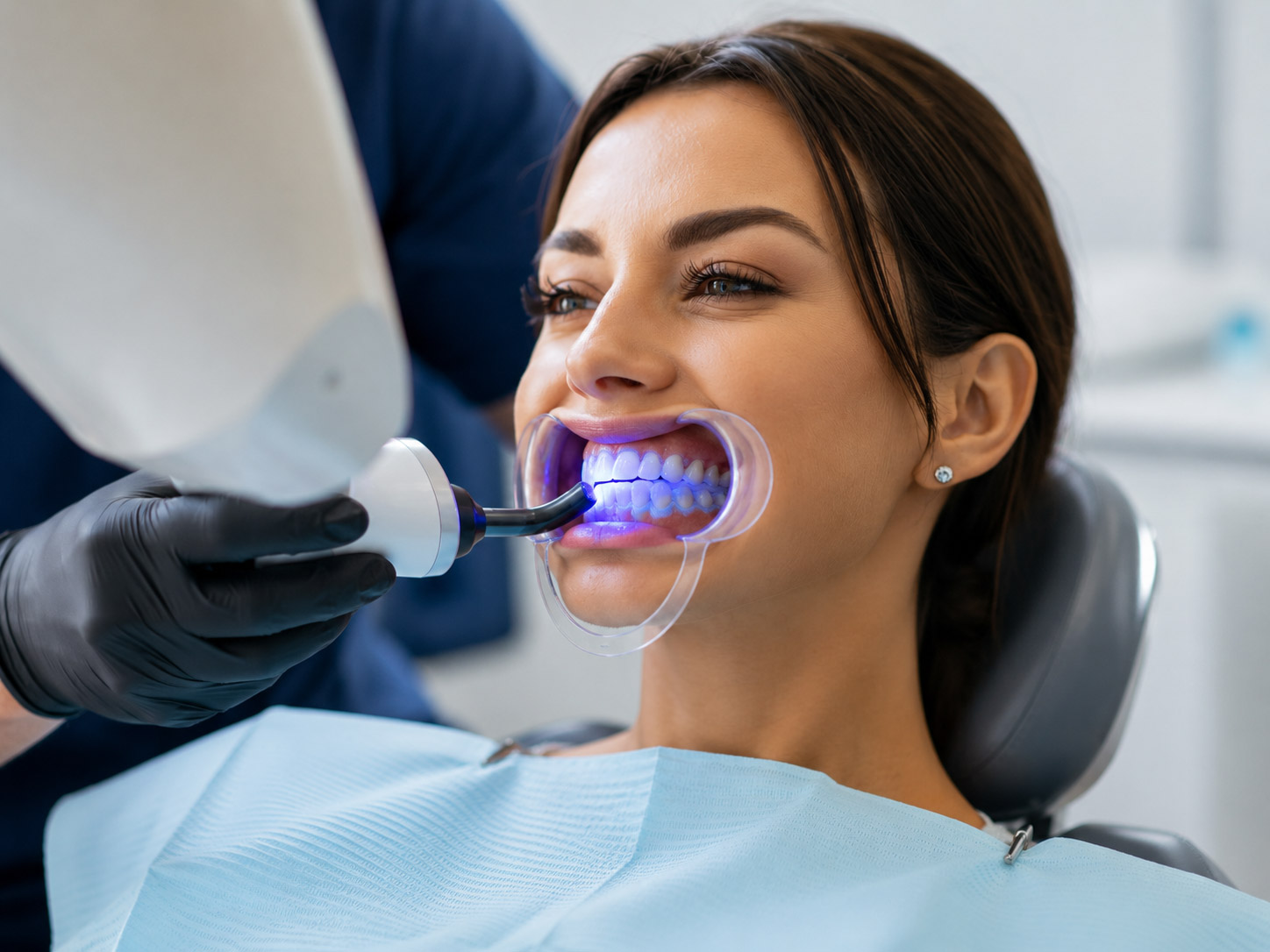Blanqueamiento dental Valencia
