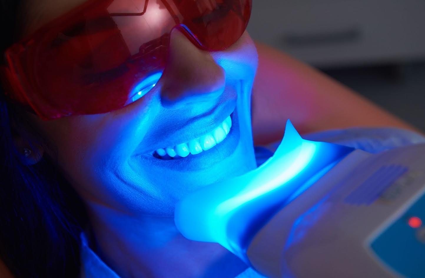 Clinica blanqueamiento dental valencia
