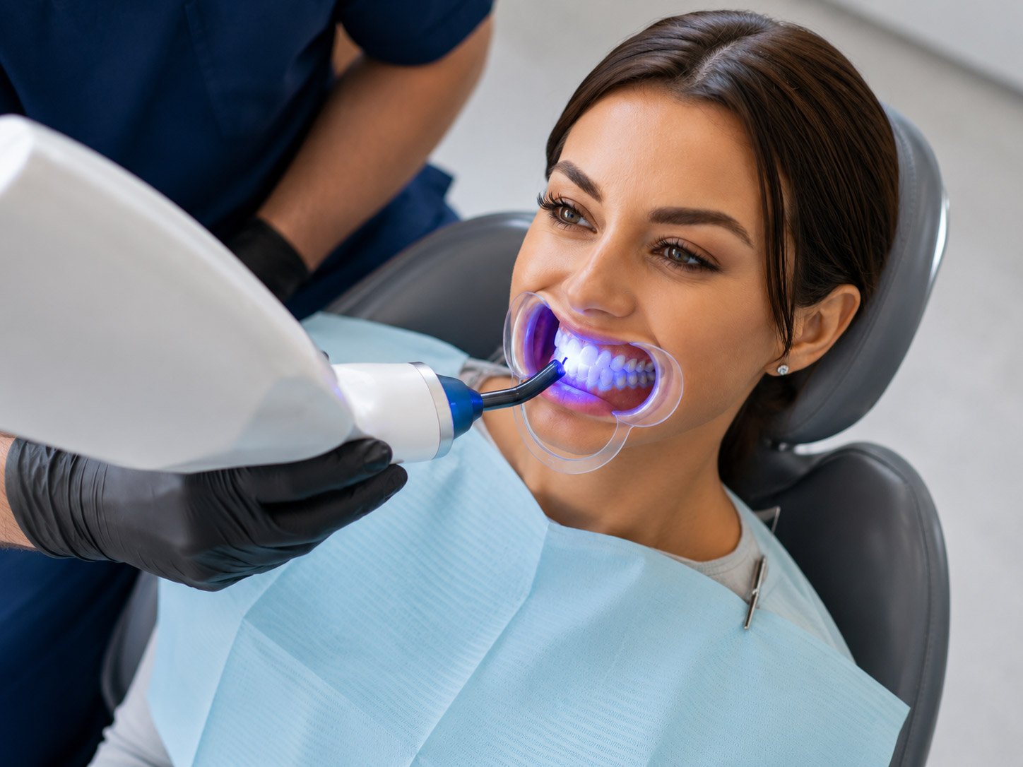 Mejor clinica blanqueamiento dental valencia