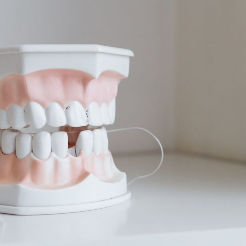 Hilo dental | Clínica Dental Valencia Marien Morata Roig