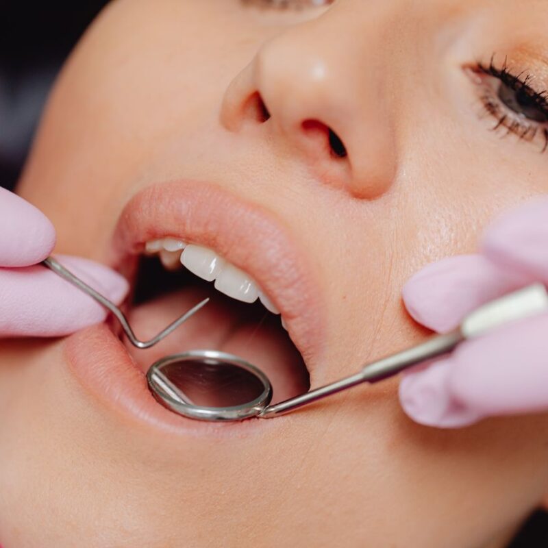 Limpieza dental | Clínica Dental Valencia Marien Morata Roig
