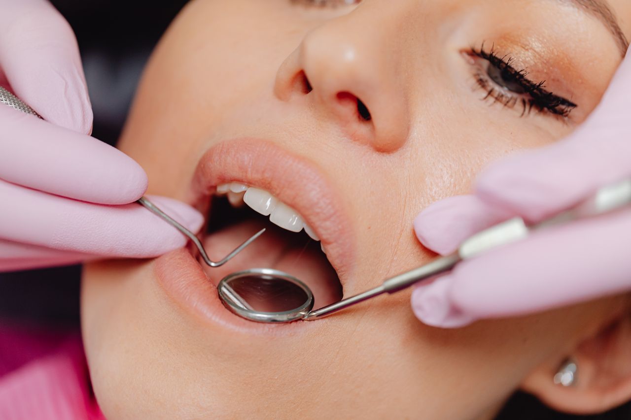 Estas son las medidas que se deben tomar tras una limpieza dental profesional