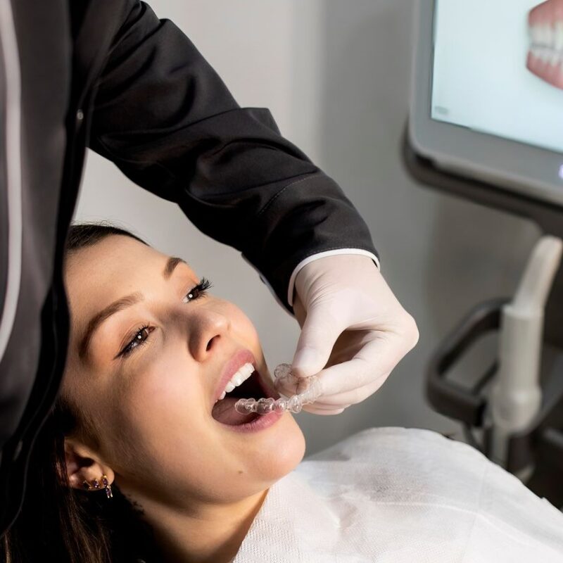 Alineación dental | Clínica Dental Valencia Marien Morata Roig