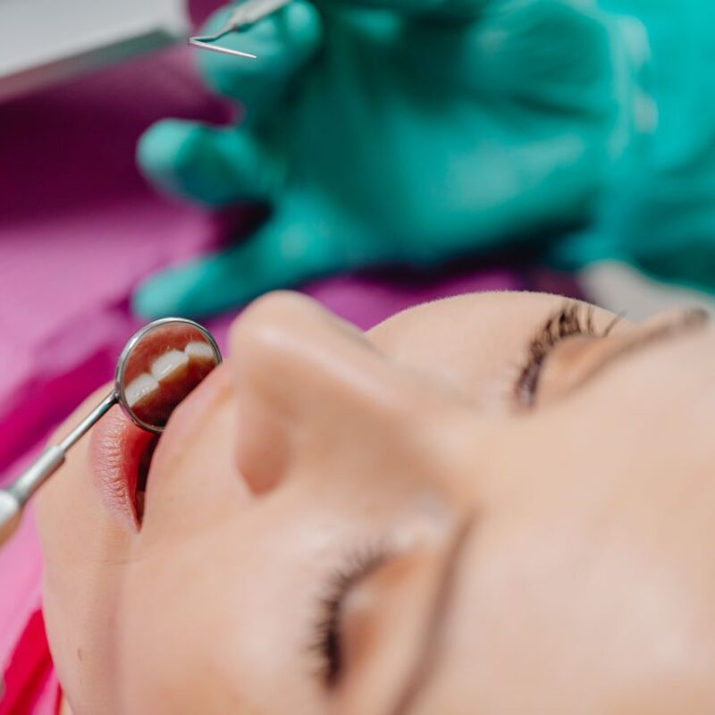 Carillas o blanqueamiento innecesarios | Dentista Marien Morata
